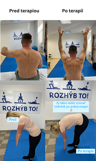 Pred a po terapii